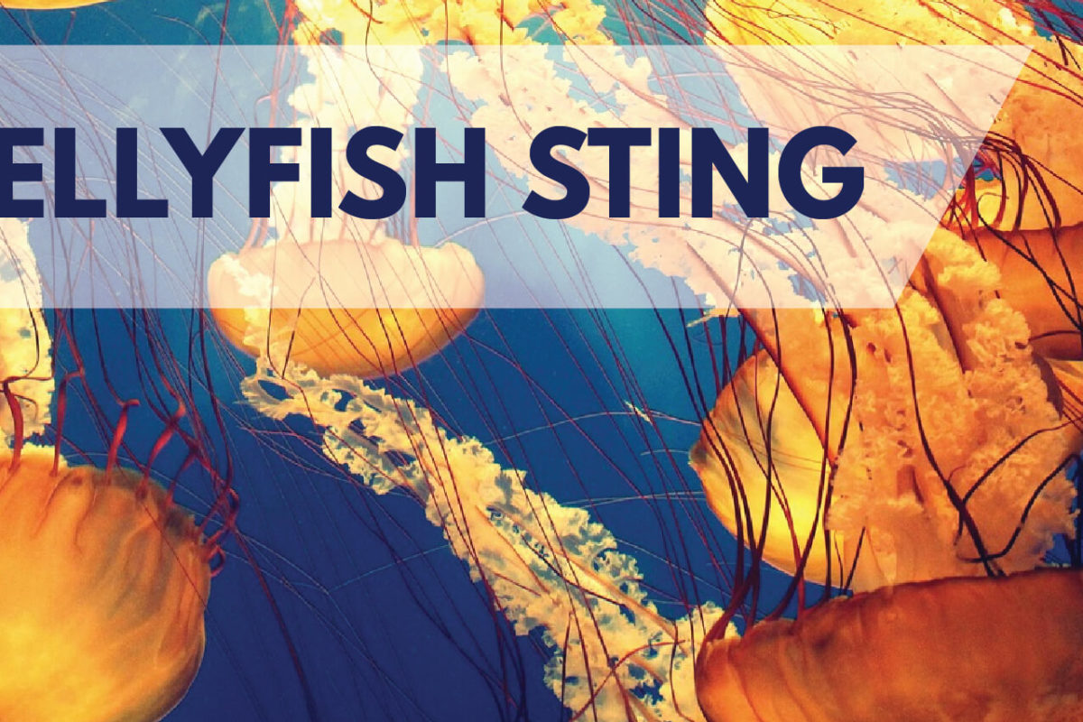 DOS AND DON’TS WHEN STUNG BY A JELLYFISH